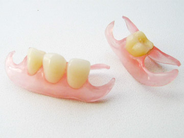 Змінні зубні імпланти